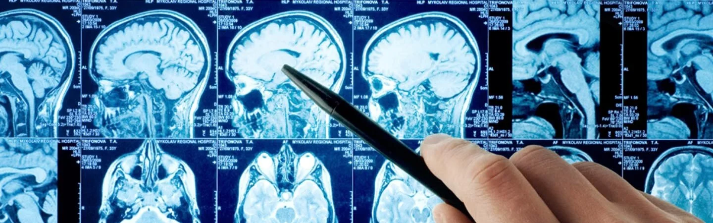 prótese craniana pelo plano de saúde