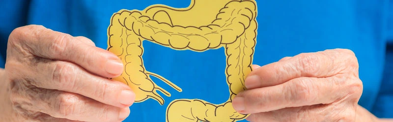 Adenocarcinoma: conheça os riscos do câncer de intestino que afeta Preta Gil