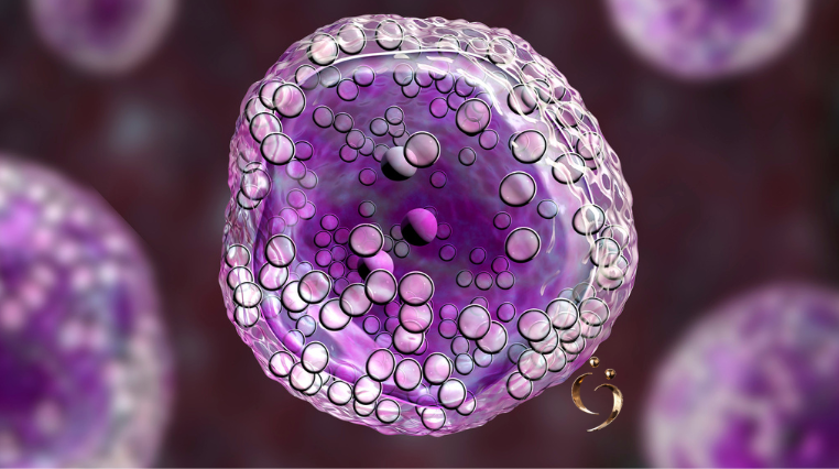 Plano de saúde é obrigado a custear o tratamento CAR-T Cell com Yescarta. Conheça as leis que garantem o direito a essa terapia de alto custo.