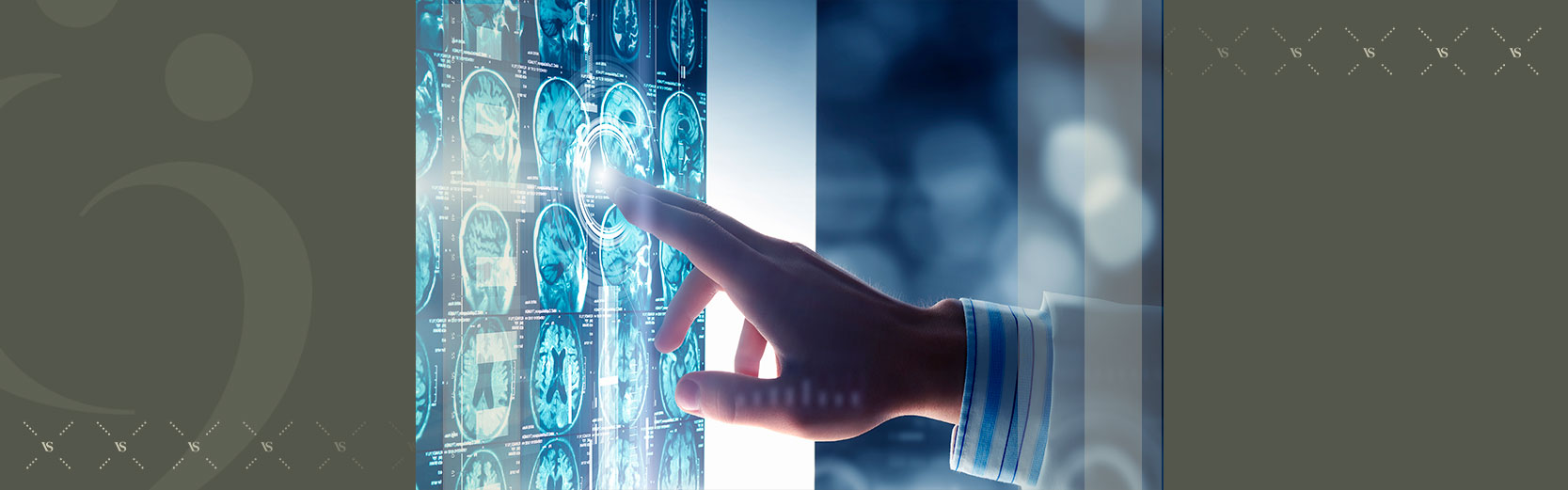 Planos de saúde devem custear cirurgias por neuronavegação